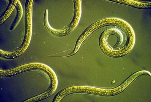Vers nématodes parasites dans l'intestin grêle humain